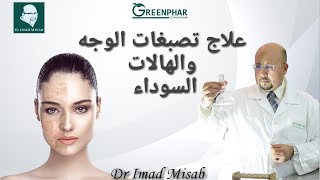 علاج التصبغات والهالات السوداء وصفة فعالة للدكتور عماد ميزاب Dr Imad Misab