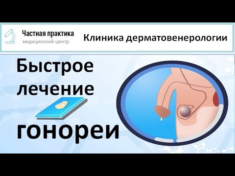 Как быстро вылечить гонорею