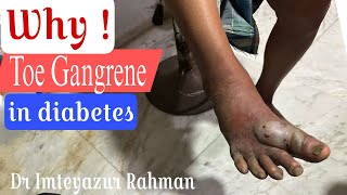 Diabetic foot ulcer management