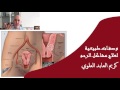 وصفات طبيعية لعلاج مشاكل الرحم ✔ الدكتور كريم العابد العلوي