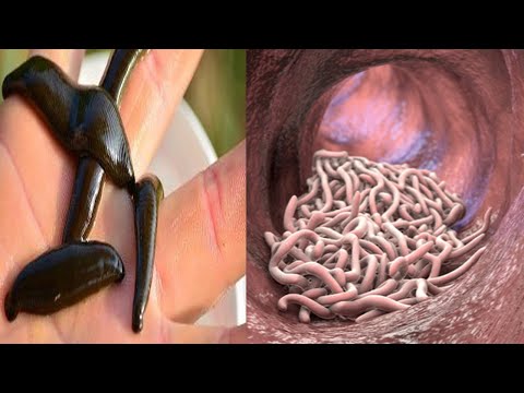 Why You Should Think Twice About Drinking Baking Soda and Water Here's What It Means! How much bakin