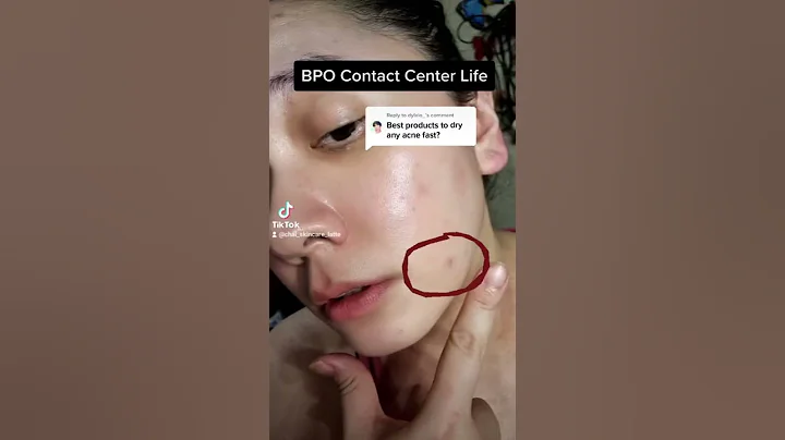 How I clear my acne fast with #larocheposay #effaclar Duo & #cosrx #salicylicacid cleanser & patches