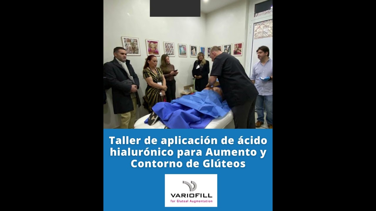 Taller IMCAS, París 2023 ,Variofill® - Ácido hialurónico para AUMENTO y CONTORNO de GLÚTEOS.