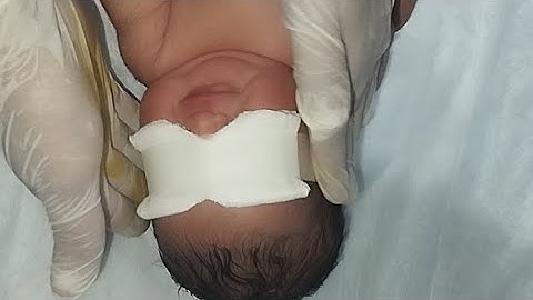 Phototherapy in the NICU: Treating Newborn Jaundice with Light"