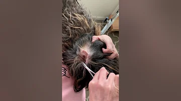 ear hair pulling