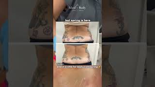 👙 Bikini Season is Calling – Time to Glow &amp; Sculpt! ☀️ | Ideal Body Med Spa Transformation