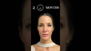 DON'T MISS! - Watch her Reverse Age by 10 Years! #shorts Wealth