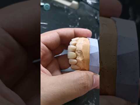 اسنان اللؤلؤ الجميلة حالة جديدة نضيفها للقائمة