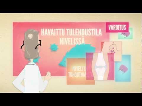 Video: Mikä On Nivelreuman Vakavuusasteikko?