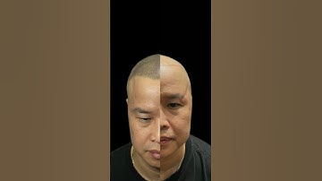 Biến hình cho anh trai hói đầu, xăm tóc hói #xămtóc