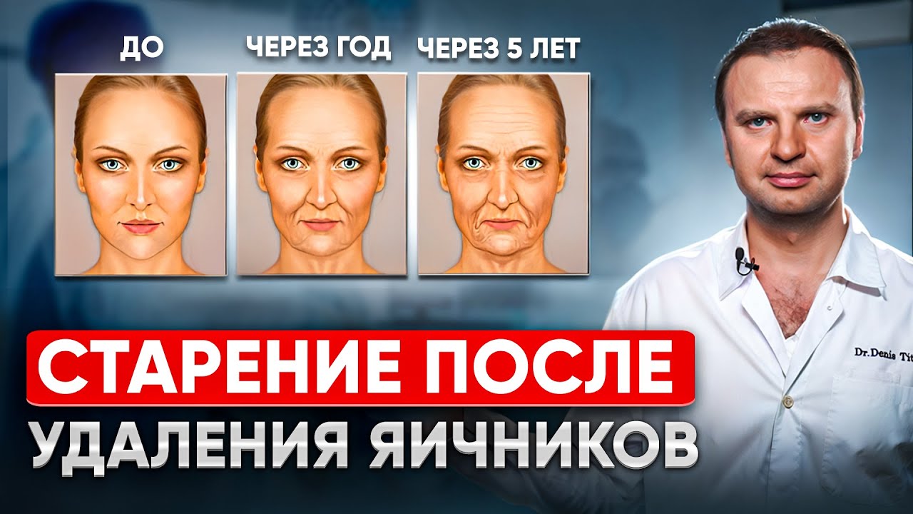 Жизнь без яичников. Удаления яичников, как быстро наступает старение, гормональная терапия.