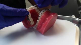 Powerscope Video - Humbertown Orthodontics