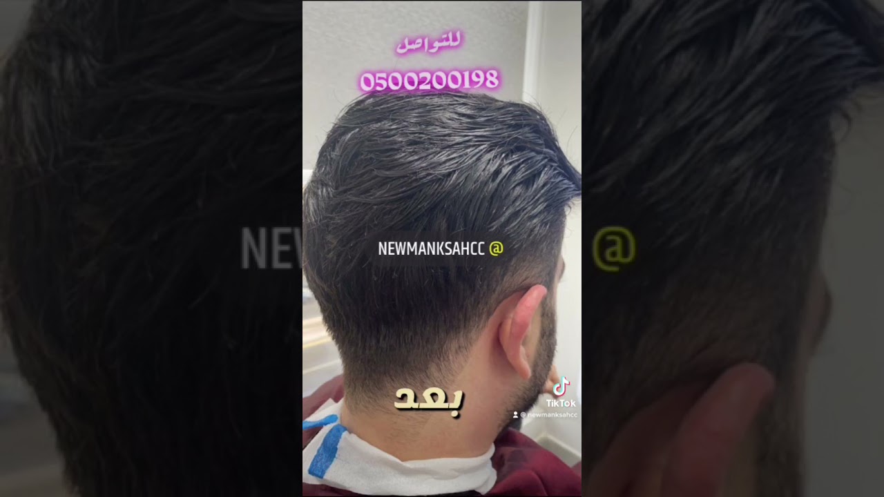 تركيب دمج شعر حل مشكله صلع شعر طبيعي في جده للرجال - YouTube