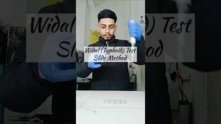Typhoid Confirm? 🤒 | Widal Test Slide Method | Result 160/160 Explained#youtubeshorts #widaltest