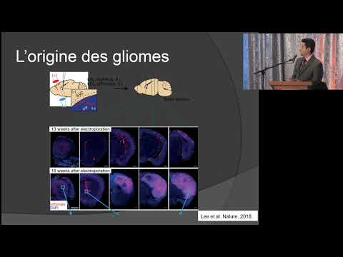 Vidéo: Nestin Et CD133: De Précieux Marqueurs Spécifiques Aux Cellules Souches Pour Déterminer Les Résultats Cliniques Des Patients Atteints De Gliome