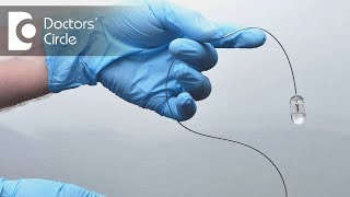 What is Capsule Endoscopy & its indications? - Dr. Ravindra B S