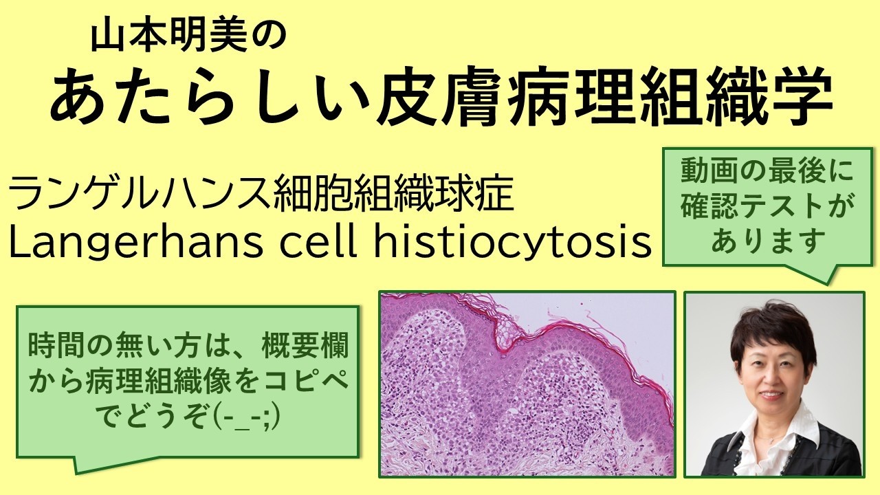 〖 Langerhans  さま専用 〗 New Dermatopathology: Langerhans Cell Histiocytosis - YouTube