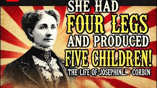 She Had Four Legs And Produced Five Children The Life Of Josephine Myrtle Corbin