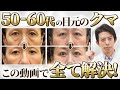 【2025年最新版】失敗する前にこれ1本！50~60代以上の切らずに治せるクマ治療の選択肢とは？【クマ取り / ハムラ法 / 裏ハムラ / 表ハムラ / 脂肪注入 / アンチエイジング】
