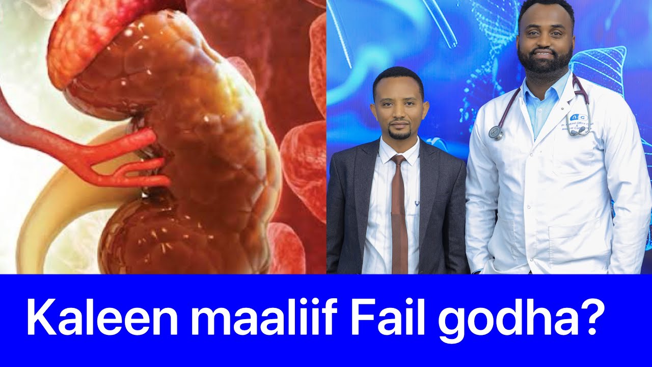 Kalee keenya maaltu hojiin ala godha ykn dadhabsiisa