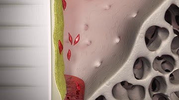 Straumann® Emdogain® – Mode of Action