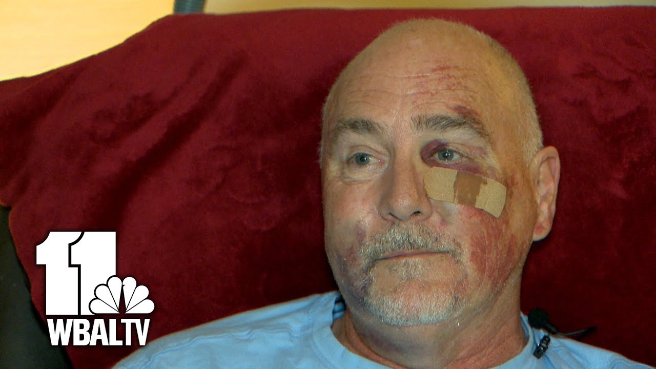 wbal-tv baltimore Former Guardian Angel brutally attacked in Fells Point