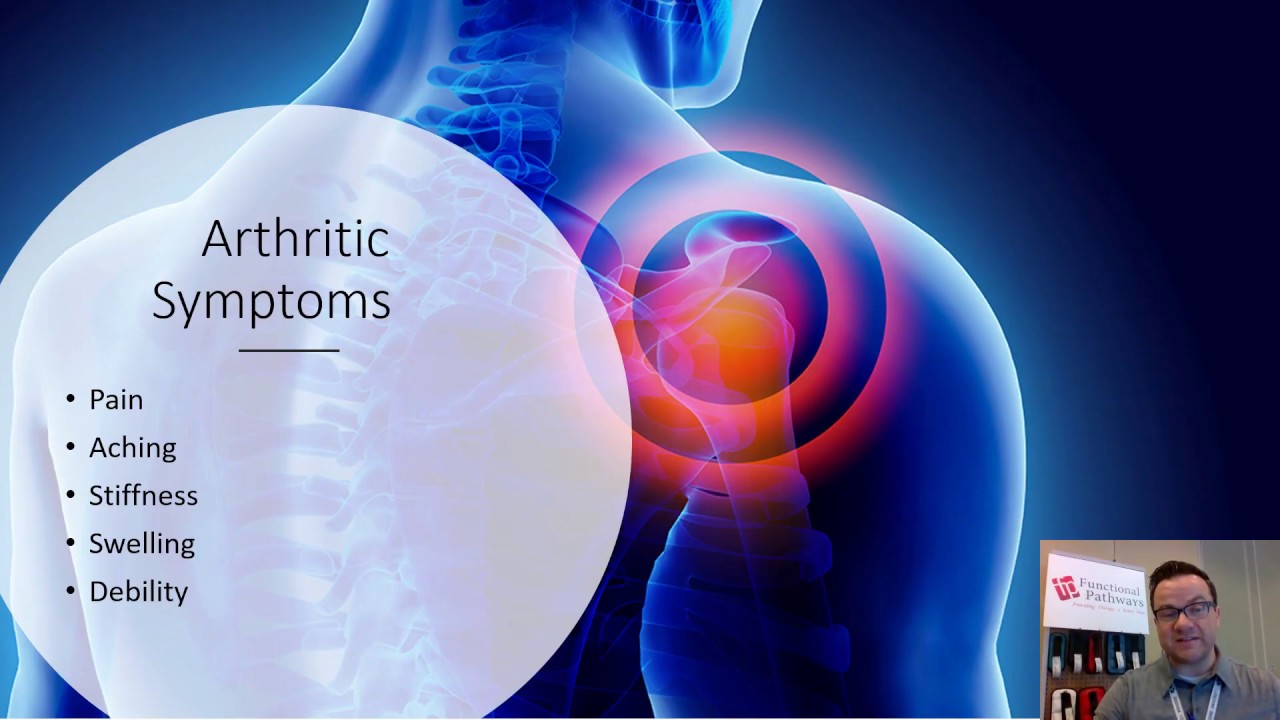 FP Rehab Winchester Arthritis YouTube