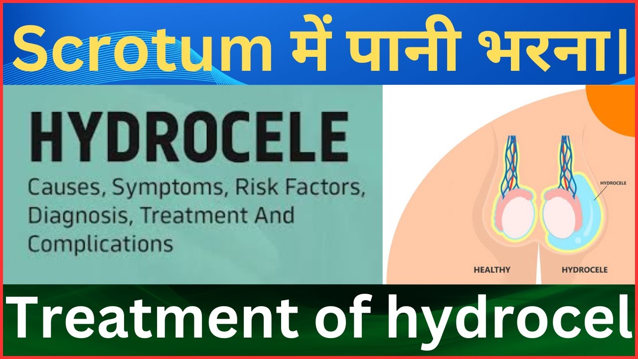 Treatment of swollen scrotum || - YouTube