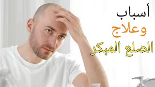 علاج الصلع المبكر؛ وما هي أهم أسبابه ؟