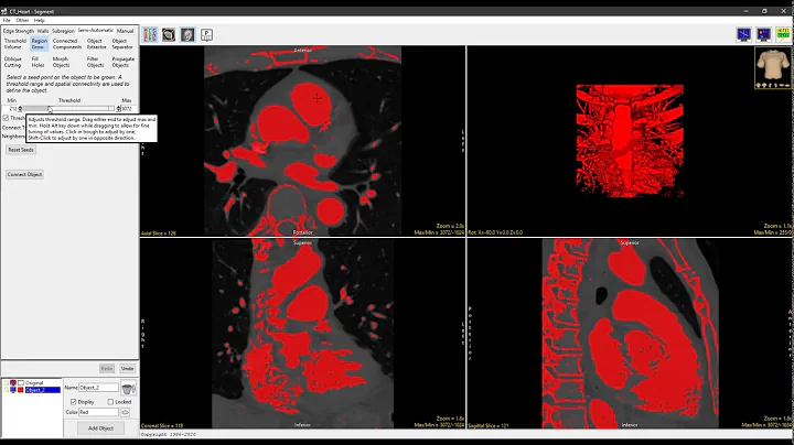 Analyze 14.0 - Segment: Region Grow 2D