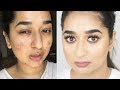 कैसे करें Scars Hide | Full Coverage Affordable Foundation Routine || Brownbeautysimor