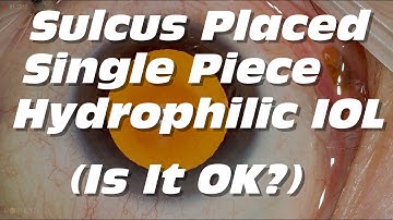 Sulcus Placed Single Piece Hydrophilic IOL - Is It OK?