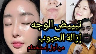 خلطة تبييض الوجه و ازالة الحبوب و الهالات السوداء بسرعة - Japanese Facial Mask