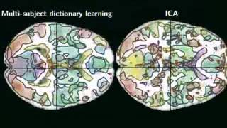 Gael Varoquaux - Learning and comparing multi-subject models of brain functional connectivity
