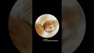 Download Lagu Pedro Pedro Trends #shorts #viral #besties #youtube #bindasskavya # subscribe 🙏 syedda merciful 💞 MP3 Download Lagu Pedro Pedro Trends #shorts #viral #besties #youtube #bindasskavya # subscribe 🙏 syedda merciful 💞 MP3