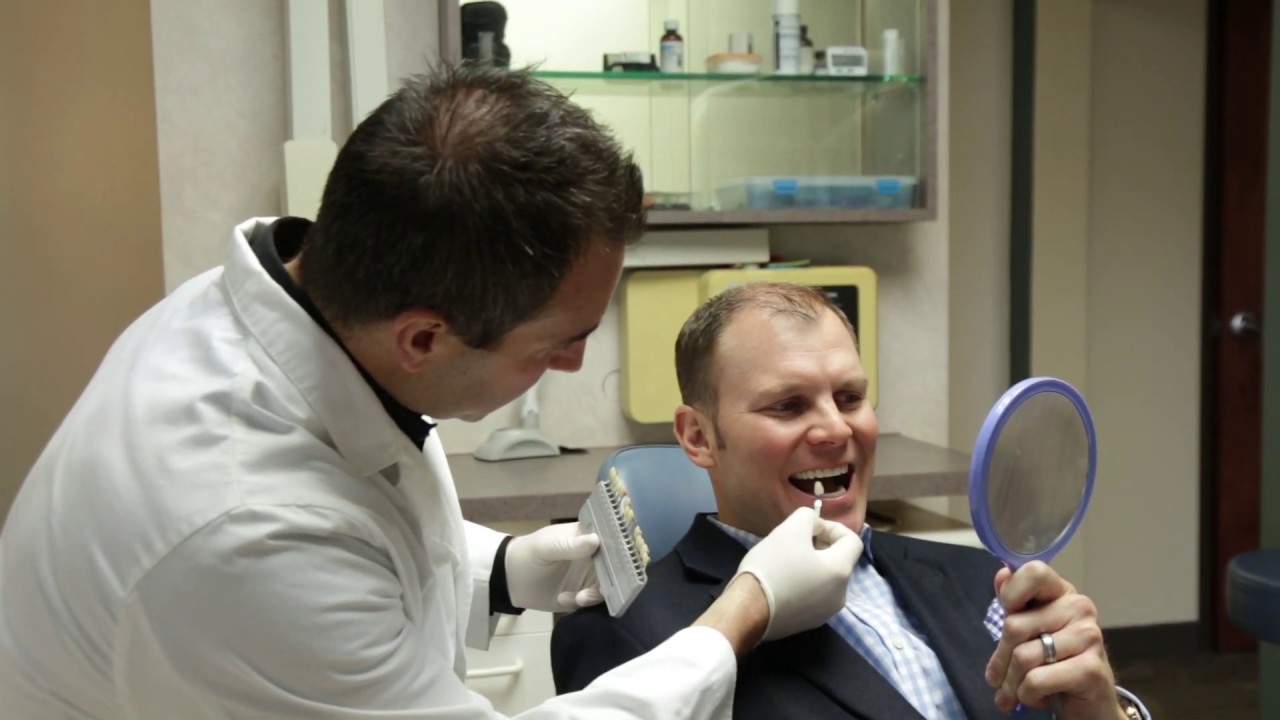 Why Do I Need Veneers?