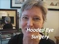 Hooded Eye Surgery - Before and After