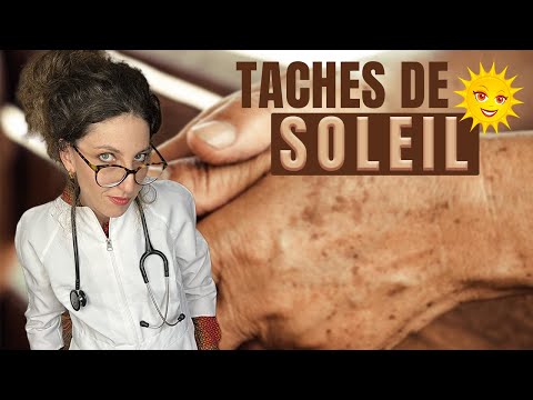 Vidéo: 3 façons d'éliminer les taches de vieillesse