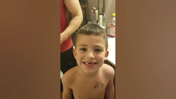 Kids tooth pull goes TERRIBLY WRONG!
