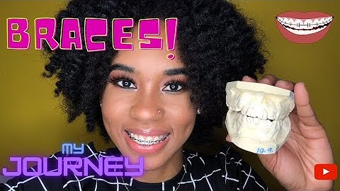 My Braces Journey | Cost of Braces in Jamaica | Braces Vlog | What to expect | Shinel xo