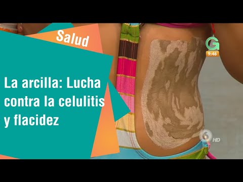 Vídeo: Aplicación De Arcilla Para Celulitis