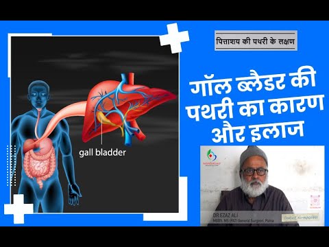 गॉल ब्लैडर स्टोन: प्रेगनेंसी में प्रेग्नेंसी के बारे में डॉ.एज़ाज़ अली ||