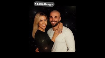 “Tired of hiding under hats? Take back your confidence with Scalp Micropigmentation — #hairtattoo