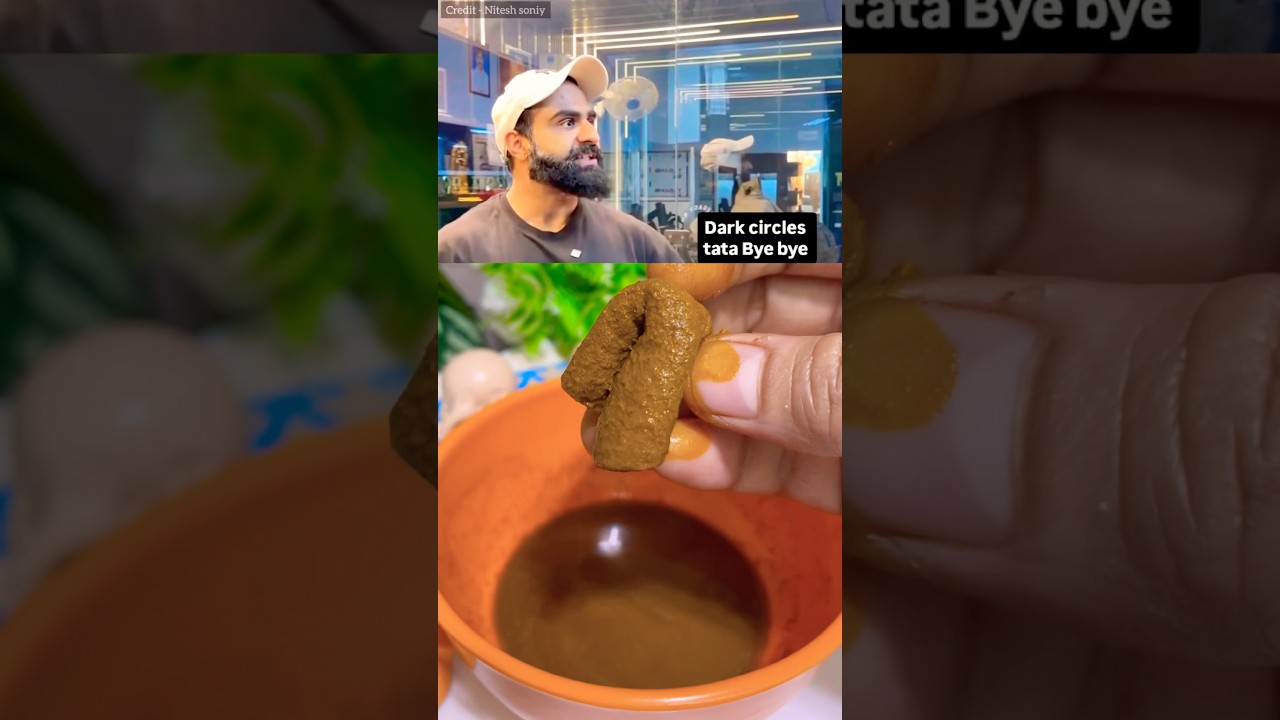 Dark Circles Tata Bye 👋 By Nitesh Soniy 