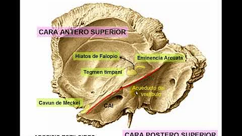 HUESO TEMPORAL