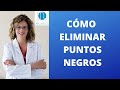 CÓMO ELIMINAR PUNTOS NEGROS