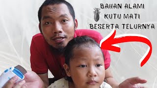 7 Cara Hilangkan Kutu Rambut dan Telurnya Secara Alami, Musnah dalam 1 Hari!. 
