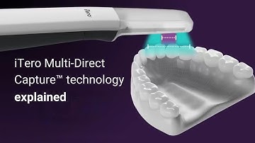 iTero Lumina™ vs. traditional intraoral scanners: A giant leap in dental tech
