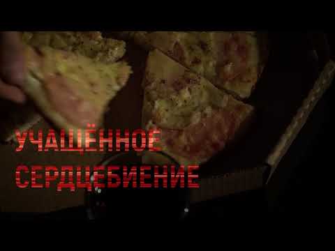 Гиподинамия