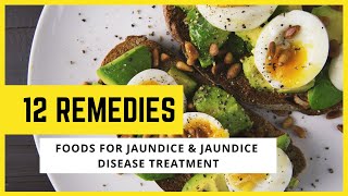 Foods For Jaundice & Jaundice Disease Treatment | 12 Remedies